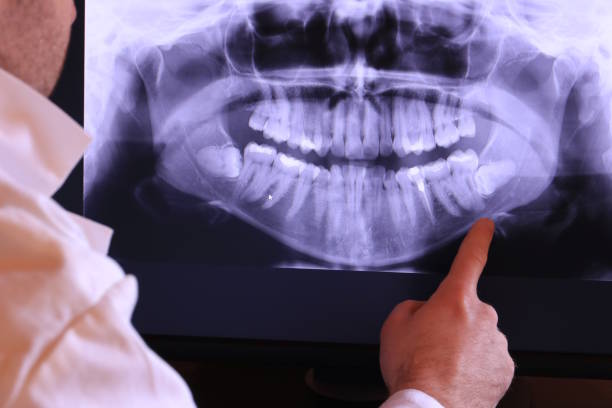 Best Emergency Denture Repair in Bithlo, FL